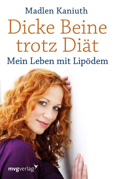 Dicke Beine trotz Diät - Mein Leben mit Lipödem