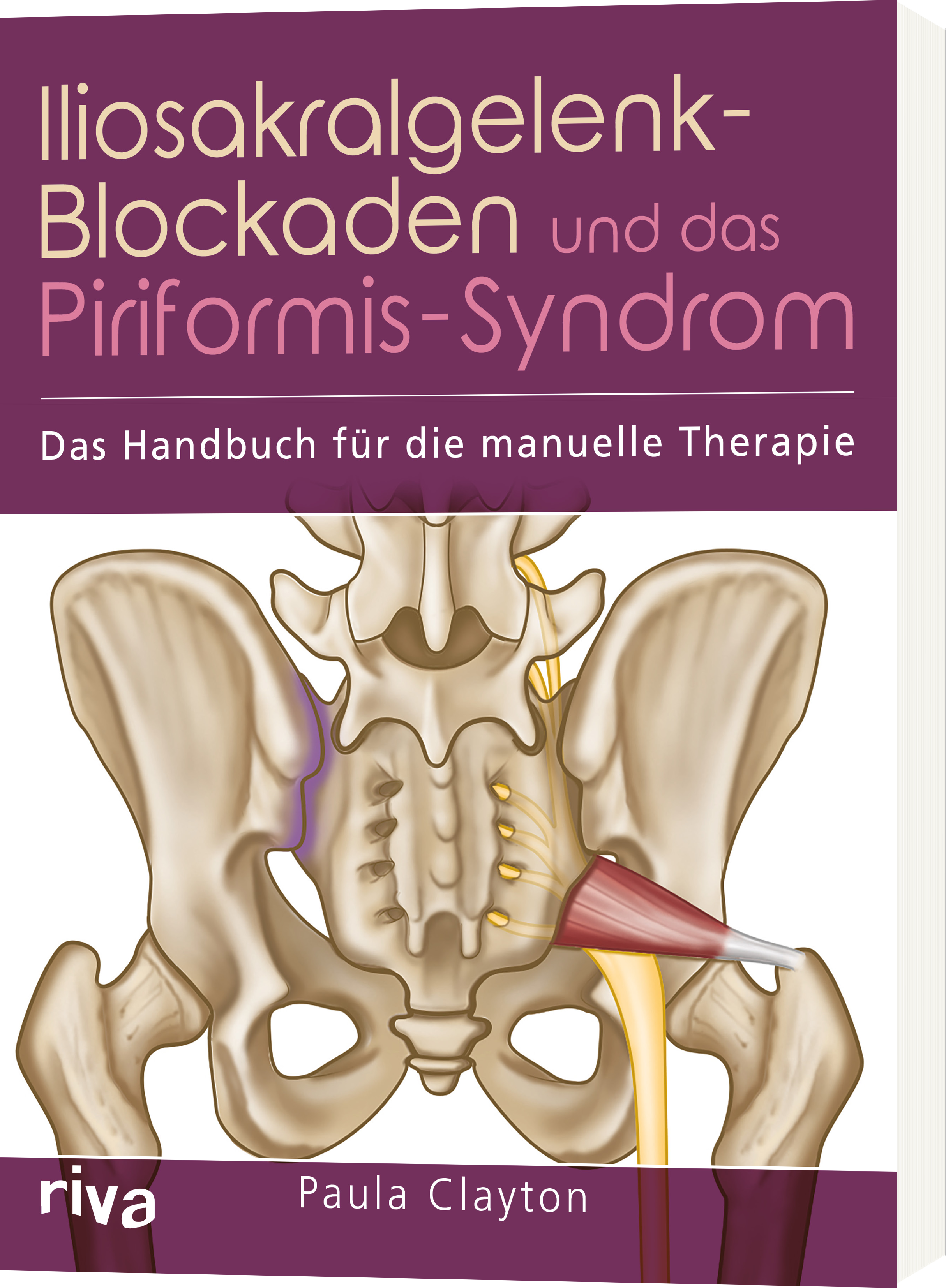 Iliosakralgelenk-Blockaden und das Piriformis-Syndrom ...